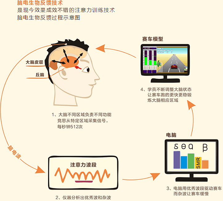 脑电生物反馈技术